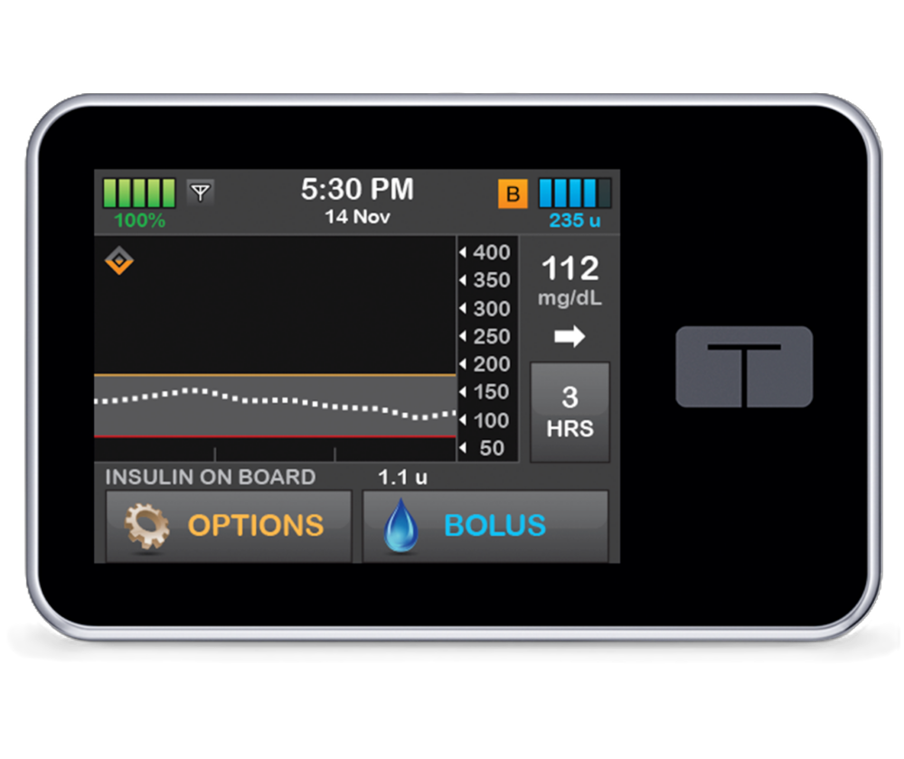 Control-IQ-1000x840-NoBG